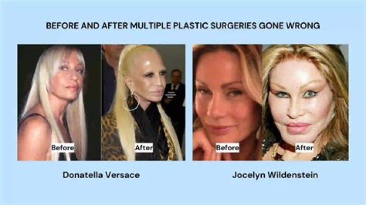 Did Tia Carrere Plastic Surgery Go Wrong? Before And After