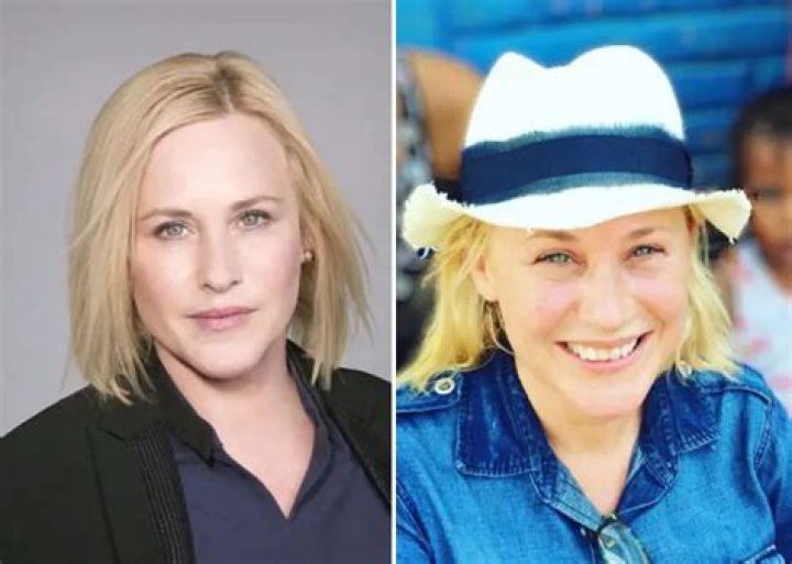Here’s Why ‌Patricia Arquette Never Fixed Her Crooked Teeth